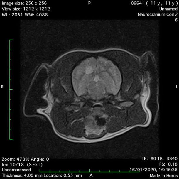 Diazepam 2mg Mri